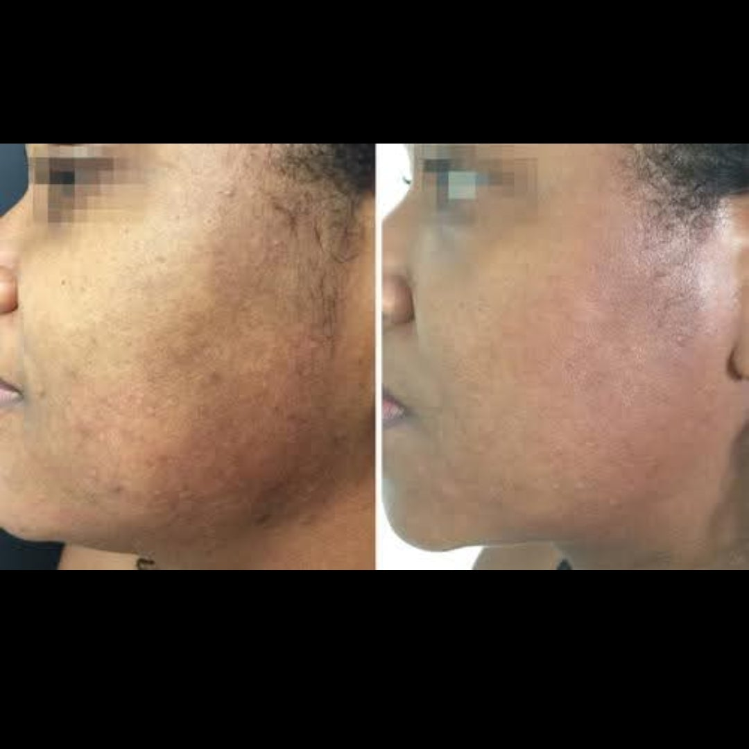 Magdala Skincare - DIY Chemical Peels
