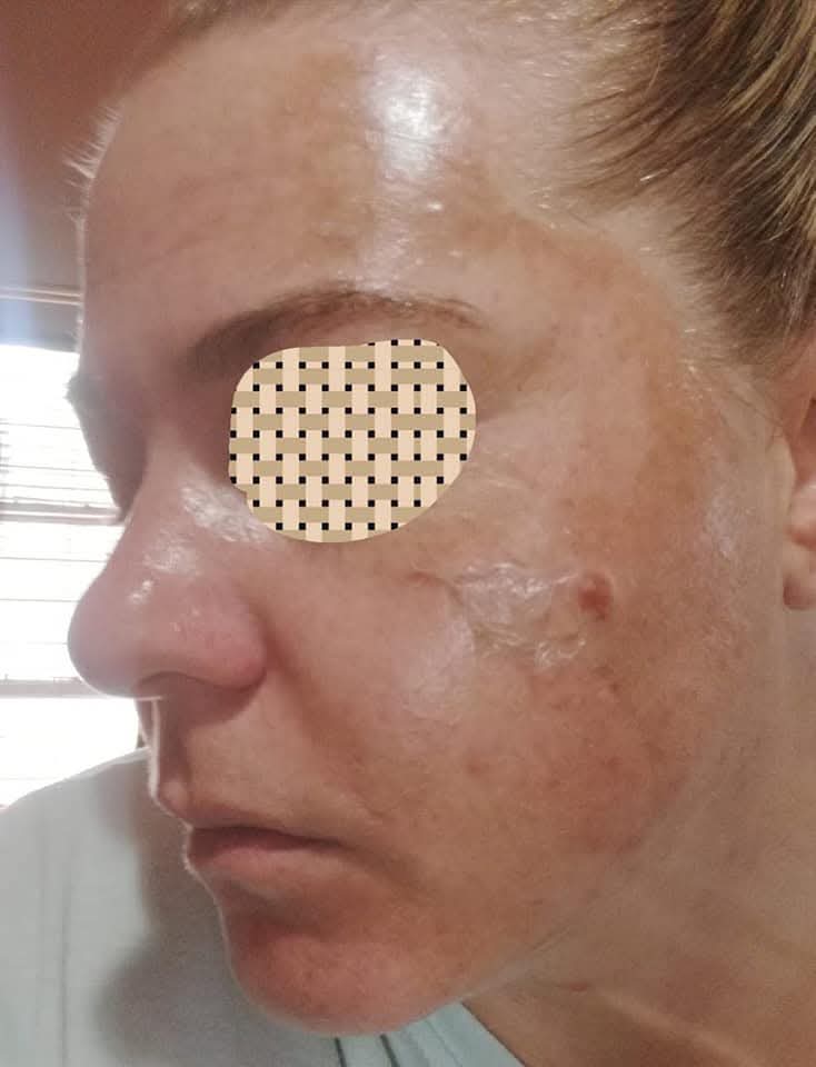 Magdala Skincare - DIY Chemical Peels